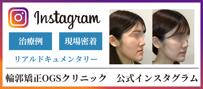 輪郭矯正OGSクリニック 公式インスタグラム