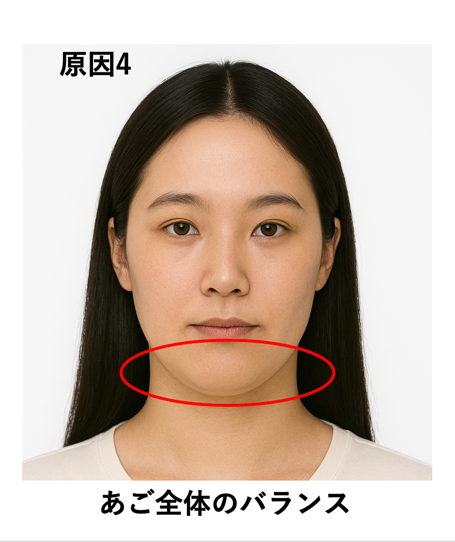 原因4：あご全体のバランス