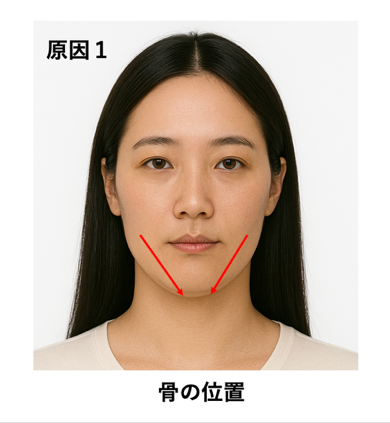 原因1：骨の位置