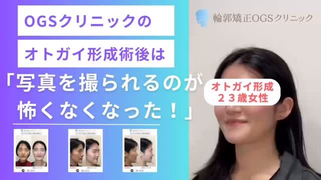 こんにちは✨
輪郭矯正OGSクリニックです🏥
⁡
今回は【オトガイ形成】を受けた患者様のリアルな感想を🎥✨実際のストーリーをご紹介します💡
⁡
📌 Beforeのお悩み
オトガイの出っ張り感、、、
👩‍🦰「写真を撮られるのが苦手だった…」
😣「人と話すときに口元を見られている気がする」
⁡
👉 そこで選んだのが【オトガイ形成術】💎
骨切りによってオトガイを内側・時計回転方向に調整し、自然でバランスの良い輪郭へ✨
⁡
✨ OGS式オトガイ形成のポイント ✨
✅ 骨をブロック状に切るため、皮膚を大きく剥がさず“たるみ予防”🙆‍♀️
✅ 骨の中抜きでサイズ調整するから“段差やゴツゴツ感なし”👌
⁡
📌 Afterの変化
😊「写真撮影がこわくなくなった！」
と嬉しいお声をいただきました💖
⁡
🏥【安心の手術体制】
・麻酔専門医が常勤する提携病院で全身麻酔対応
・院長 吉川が全て執刀👨‍⚕️
・術後は入院OK。ホテル泊ナシで安心😊
⁡
⚠️【手術リスク】
・下口唇の一時的な感覚麻痺（動きに問題なし）
・腫れや痛み
・創部感染 など
⁡
まずはカウンセリングでお気持ちをお聞かせください🪞
「自分にとってどんな治療が良いのか？」一緒に考えましょう✨
⁡
📍 川越｜輪郭矯正OGSクリニック
🌐 ogs-clinic.jp ｜ 📞 049-226-1515
🎥 YouTube・Xでも症例発信中！ハイライトからチェック✅
⁡
#輪郭形成 #患者様の声 #体験談 #アゴがでている #横顔美人
#コンプレックス解消 #オトガイ形成 #骨切り #輪郭矯正OGSクリニック #美容整形